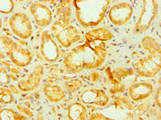 Immunohistochemistry of paraffin-embedded human kidney tissue using CSB-PA001912DSR2HU at dilution of 1:100