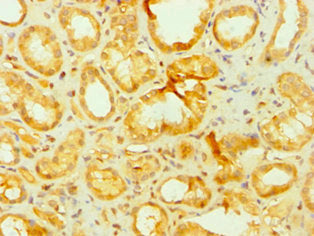 Immunohistochemistry of paraffin-embedded human kidney tissue using CSB-PA001912DSR2HU at dilution of 1:100