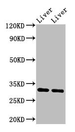 Western Blot Positive WB detected in: Rat liver tissue, Mouse liver tissue All lanes: APOA1 antibody at 3.4µg/ml Secondary Goat polyclonal to rabbit IgG at 1/50000 dilution Predicted band size: 31 kDa Observed band size: 31 kDa