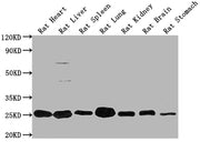 Western Blot Positive WB detected in: Rat Heart tissue, Rat Liver tissue, Rat Spleen tissue, Rat Lung tissue, Rat Kidney tissue, Rat Brain tissue, Rat Stomach tissue All lanes: Apoa1 antibody at 1:2000 Secondary Goat polyclonal to rabbit IgG at 1/...