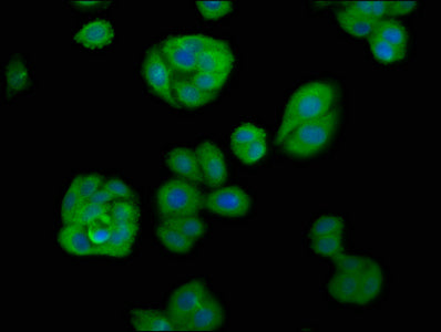 Immunofluorescence staining of HepG2 cells with CSB-PA001919LA01HU at 1:66, counter-stained with DAPI. The cells were fixed in 4% formaldehyde, permeabilized using 0.2% Triton X-100 and blocked in 10% normal Goat Serum. The cells were then incubat...