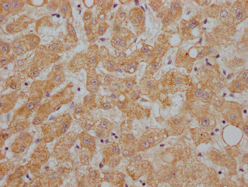 IHC image of CSB-PA001930NA01HU diluted at 1:200 and staining in paraffin-embedded human liver tissue performed on a Leica BondTM system. After dewaxing and hydration, antigen retrieval was mediated by high pressure in a citrate buffer (pH 6.0). S...