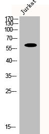 Western Blot analysis of Jurkat cells using CYP1B1 Polyclonal Antibody