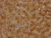 IHC image of CSB-PA001932OA01HU diluted at 1:500 and staining in paraffin-embedded human liver tissue performed on a Leica BondTM system. After dewaxing and hydration, antigen retrieval was mediated by high pressure in a citrate buffer (pH 6.0). S...