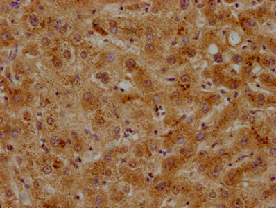 IHC image of CSB-PA001932OA01HU diluted at 1:500 and staining in paraffin-embedded human liver tissue performed on a Leica BondTM system. After dewaxing and hydration, antigen retrieval was mediated by high pressure in a citrate buffer (pH 6.0). S...
