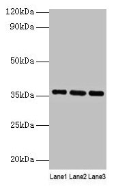 Western blot All lanes: Apoe antibody at 2µg/ml Lane 1: Mouse liver tissue Lane 2: Mouse brain tissue Lane 3: Mouse lung tissue Secondary Goat polyclonal to rabbit IgG at 1/10000 dilution Predicted band size: 36 kDa Observed band size: 36 kDa
