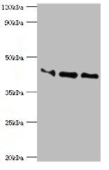 Western blot All lanes: Apolipoprotein L1 antibody at 10ug/ml Lane 1: A549 whole cell lysate Lane 2: Hela whole cell lysate Lane 3: HepG2 whole cell lysate Secondary Goat polyclonal to rabbit IgG at 1/10000 dilution Predicted band size: 44, 46, 43...