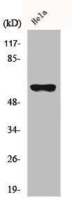Western Blot analysis of HeLa cells using CYP27A1 Polyclonal Antibody