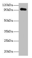 Western blot All lanes: APP antibody at 2µg/ml + HL60 whole cell lysate Secondary Goat polyclonal to rabbit IgG at 1/10000 dilution Predicted band size: 87, 35, 77, 79, 81, 83, 85, 86, 73 kDa Observed band size: 95 kDa