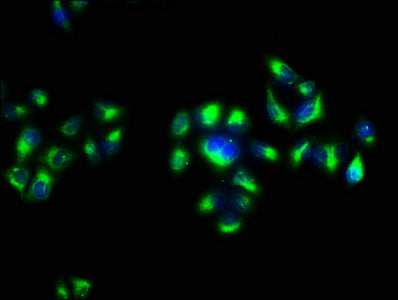 Immunofluorescence staining of Hela cells with CSB-PA001950OJ01HU at 1:133, counter-stained with DAPI. The cells were fixed in 4% formaldehyde, permeabilized using 0.2% Triton X-100 and blocked in 10% normal Goat Serum. The cells were then incubat...