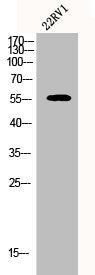 Western Blot analysis of 22RV1 cells using CYP2A7 Polyclonal Antibody