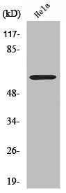 Western Blot analysis of LOVO cells using CYP2U1 Polyclonal Antibody