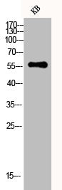 Western Blot analysis of KB cells using CYP3A4 Polyclonal Antibody