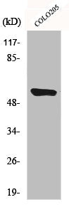 Western Blot analysis of HeLa cells using CYP4A11/22 Polyclonal Antibody