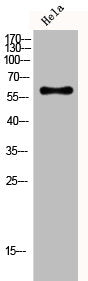 Western Blot analysis of Hela cells using CYP4F2 Polyclonal Antibody