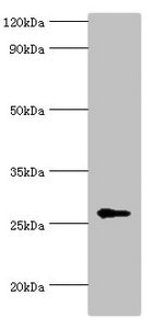 Western blot All lanes: N-alpha-acetyltransferase 10 antibody at 5ug/ml + Hela whole cell lysate Secondary Goat polyclonal to rabbit IgG at 1/10000 dilution Predicted band size: 27, 25 kDa Observed band size: 27 kDa