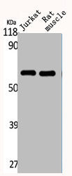 Western Blot analysis of Jurkat RAT-MUSCLE cells using CYP4Z1/2 Polyclonal Antibody