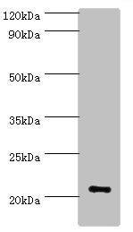 Western blot All lanes: ARF3 antibody at 6ug/ml + Mouse brain tissue Secondary Goat polyclonal to rabbit IgG at 1/10000 dilution Predicted band size: 21, 17 kDa Observed band size: 21 kDa