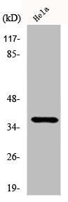 Western Blot analysis of HeLa cells using CysLTR2 Polyclonal Antibody