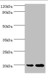 Western blot All lanes: ARF6 antibody at 2ug/ml Lane 1: 293T whole cell lysate Lane 2: HepG2 whole cell lysate Secondary Goat polyclonal to rabbit IgG at 1/10000 dilution Predicted band size: 20 kDa Observed band size: 20 kDa