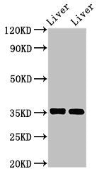 Western Blot Positive WB detected in: Mouse liver tissue, Rat liver tissue All lanes: ARG1 antibody at 2.8µg/ml Secondary Goat polyclonal to rabbit IgG at 1/50000 dilution Predicted band size: 35, 36, 26 kDa Observed band size: 35 kDa
