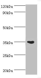 Western blot All lanes: Arginase-1 antibody at 3ug/ml + Mouse liver tissue Secondary Goat polyclonal to rabbit IgG at 1/10000 dilution Predicted band size: 35, 36, 26 kDa Observed band size: 35 kDa