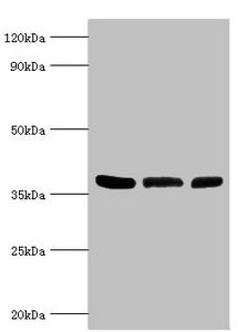 Western blot All lanes: ARG2 antibody at 5µg/ml Lane 1: Mouse liver tissue Lane 2: 293T whole cell lysate Lane 3: Mouse kidney tissue Secondary Goat polyclonal to rabbit IgG at 1/10000 dilution Predicted band size: 39 kDa Observed band size: 39 kDa