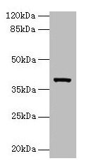 Western blot All lanes: Arg2 antibody at 10µg/ml + Jurkat whole cell lysate Secondary Goat polyclonal to rabbit IgG at 1/10000 dilution Predicted band size: 39 kDa Observed band size: 39 kDa