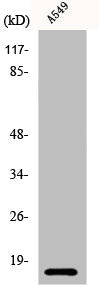Western Blot analysis of A549 cells using Cystatin B Polyclonal Antibody