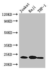 Western Blot Positive WB detected in: Jurkat whole cell lysate, Raji whole cell lysate, THP-1 whole cell lysate All lanes: ARHGDIB antibody at 3µg/ml Secondary Goat polyclonal to rabbit IgG at 1/50000 dilution Predicted band size: 23 kDa Observed...