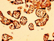 IHC image of CSB-PA002043LA01HU diluted at 1:500 and staining in paraffin-embedded human placenta tissue performed on a Leica BondTM system. After dewaxing and hydration, antigen retrieval was mediated by high pressure in a citrate buffer (pH 6.0)...