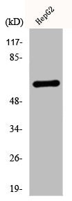 Western Blot analysis of HepG2 cells using Cytokeratin 5 Polyclonal Antibody