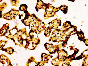 IHC image of CSB-PA002058LA01HU diluted at 1:500 and staining in paraffin-embedded human placenta tissue performed on a Leica BondTM system. After dewaxing and hydration, antigen retrieval was mediated by high pressure in a citrate buffer (pH 6.0)...