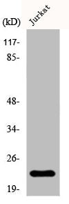 Western Blot analysis of Jurkat cells using D54 Polyclonal Antibody
