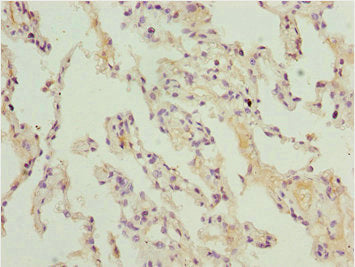 Immunohistochemistry of paraffin-embedded human lung tissue using CSB-PA002069ESR1HU at dilution of 1:100