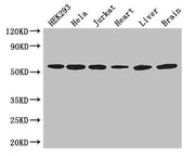 Western Blot Positive WB detected in: HEK293 whole cell lysate, Hela whole cell lysate, Jurkat whole cell lysate, Mouse heart tissue, Mouse liver tissue, Mouse brain tissue All lanes: ARIH2 antibody at 3ug/ml Secondary Goat polyclonal to rabbit Ig...