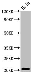 Western Blot Positive WB detected in: Hela whole cell lysate All lanes: ARL1 antibody at 5.1µg/ml Secondary Goat polyclonal to rabbit IgG at 1/50000 dilution Predicted band size: 21, 19 kDa Observed band size: 21 kDa