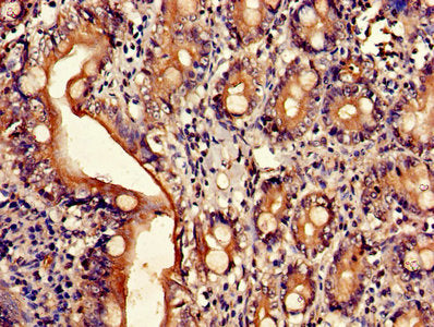 Immunohistochemistry of paraffin-embedded human small intestine tissue using CSB-PA002087LA01HU at dilution of 1:100