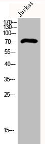 Western Blot analysis of Jurkat cells using DCAMKL3 Polyclonal Antibody