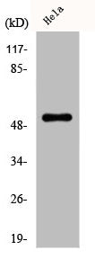 Western Blot analysis of HepG2 cells using Desmin Polyclonal Antibody