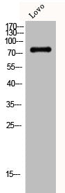 Western Blot analysis of Lovo cells using DGK-α Polyclonal Antibody
