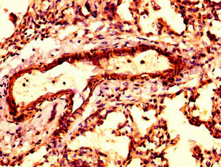 IHC image of CSB-PA002130LA01HU diluted at 1:300 and staining in paraffin-embedded human lung tissue performed on a Leica BondTM system. After dewaxing and hydration, antigen retrieval was mediated by high pressure in a citrate buffer (pH 6.0). Se...