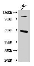 Western Blot Positive WB detected in: K562 whole cell lysate All lanes: ARRB1 antibody at 4.6µg/ml Secondary Goat polyclonal to rabbit IgG at 1/50000 dilution Predicted band size: 48, 47 kDa Observed band size: 48 kDa