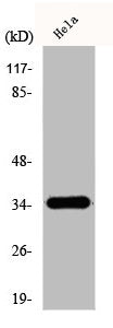 Western Blot analysis of HeLa cells using D-GPCR Polyclonal Antibody