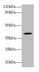 Western blot All lanes: ARSB antibody at 2µg/ml + Mouse brain tissue Secondary Goat polyclonal to rabbit lgG at 1/15000 dilution Predicted band size: 60, 46 kDa Observed band size: 40 kDa