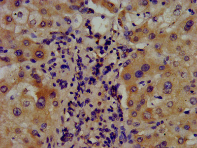 IHC image of CSB-PA002146LA01HU diluted at 1:400 and staining in paraffin-embedded human liver tissue performed on a Leica BondTM system. After dewaxing and hydration, antigen retrieval was mediated by high pressure in a citrate buffer (pH 6.0). S...