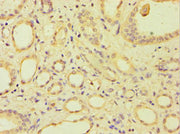 Immunohistochemistry of paraffin-embedded human kidney tissue using CSB-PA002148ESR1HU at dilution of 1:100