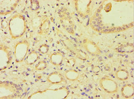 Immunohistochemistry of paraffin-embedded human kidney tissue using CSB-PA002148ESR1HU at dilution of 1:100
