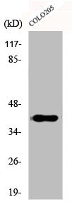 Western Blot analysis of COLO205 cells using Dlx-4 Polyclonal Antibody
