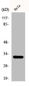 Western Blot analysis of COLO205 cells using Dlx-5 Polyclonal Antibody